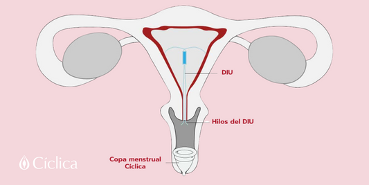 ¿Puedo usar la copa menstrual si tengo un DIU?